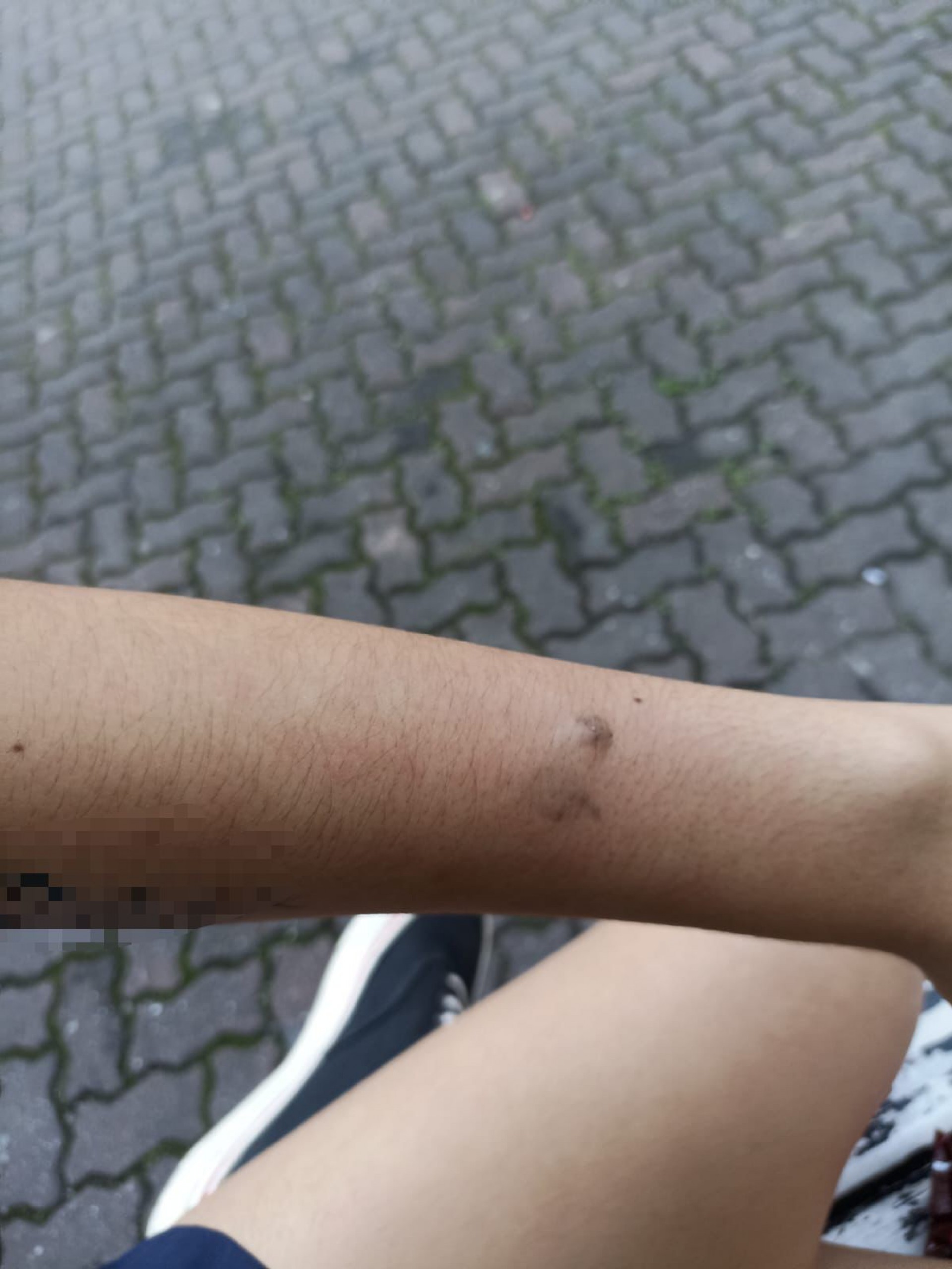 A jovem apresentou hematomas no bra&ccedil;o