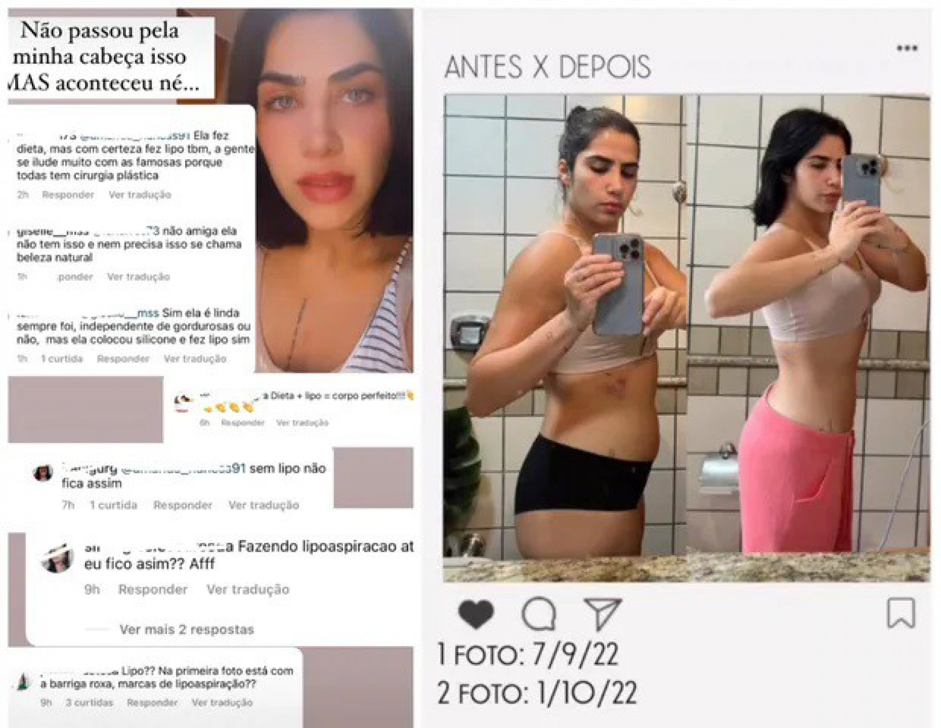 J&eacute;ssica Beatriz Costa, filha do cantor Leonardo, responde cr&iacute;ticas sobre cirurgia pl&aacute;stica - Reprodu&ccedil;&atilde;o / Instagram