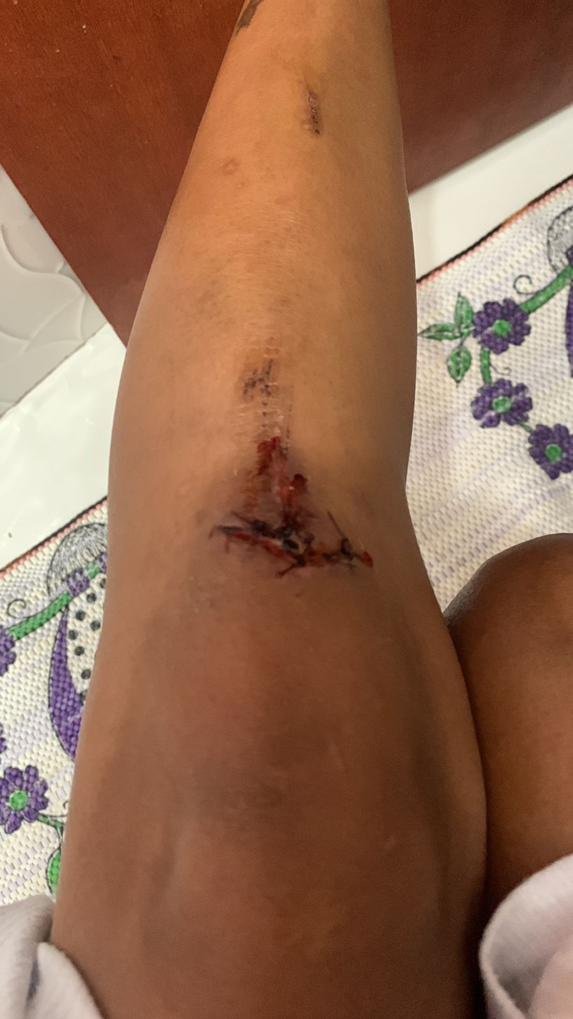 Fernanda conta que era constantemente agredida por Ad&iacute;lio