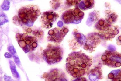 Vigilância estadual e municipal fazem visita de controle à Histoplasmose