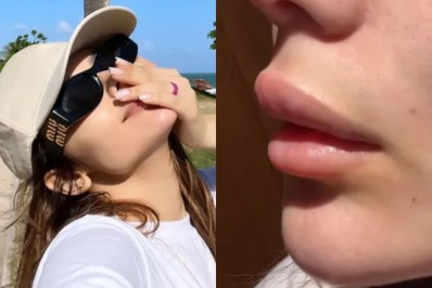 Eslovênia Marques desabafa nas redes sociais após inchaço nos lábios: 'Bizarro'