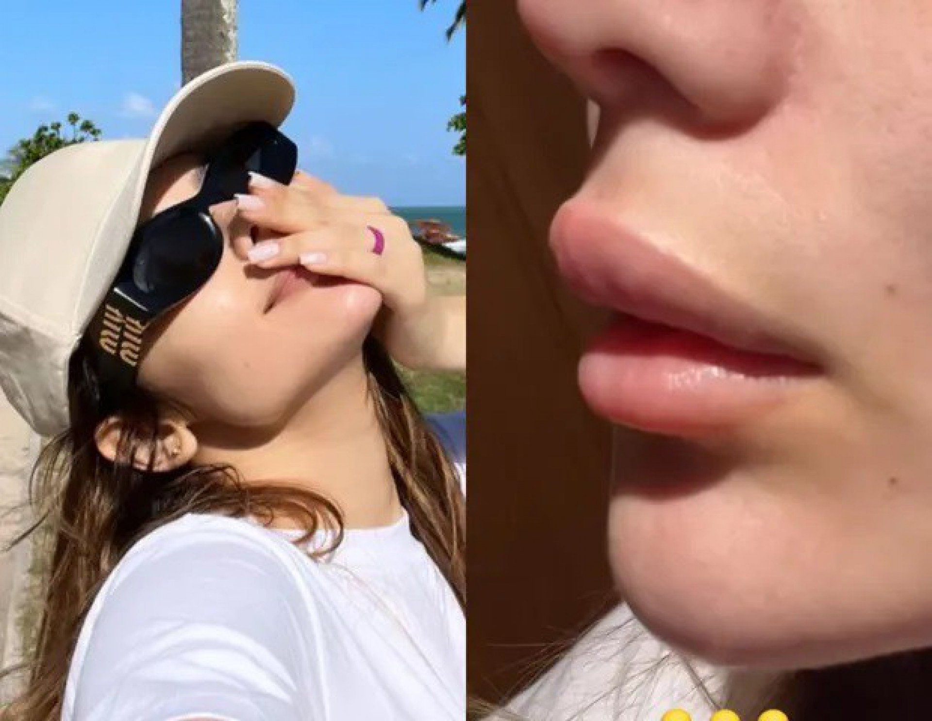 Eslovênia Marques desabafa sobre inchaço nos lábios - Reprodução / Instagram