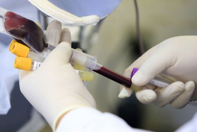 Doações de sangue caíram 30% em setembro, segundo Inca