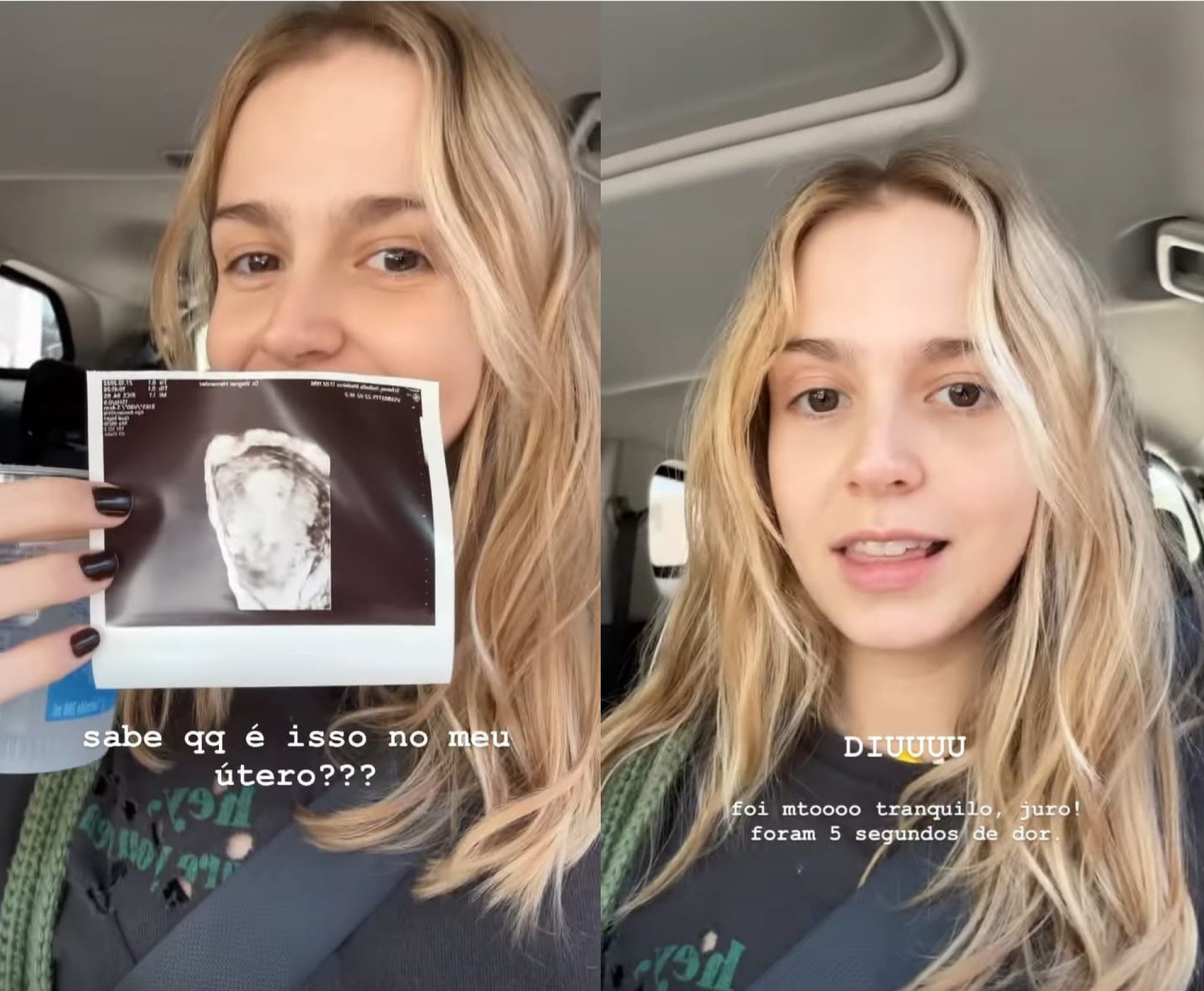 Isabella Scherer implantou DIU após o nascimento dos filhos  - Reprodução/Instagram