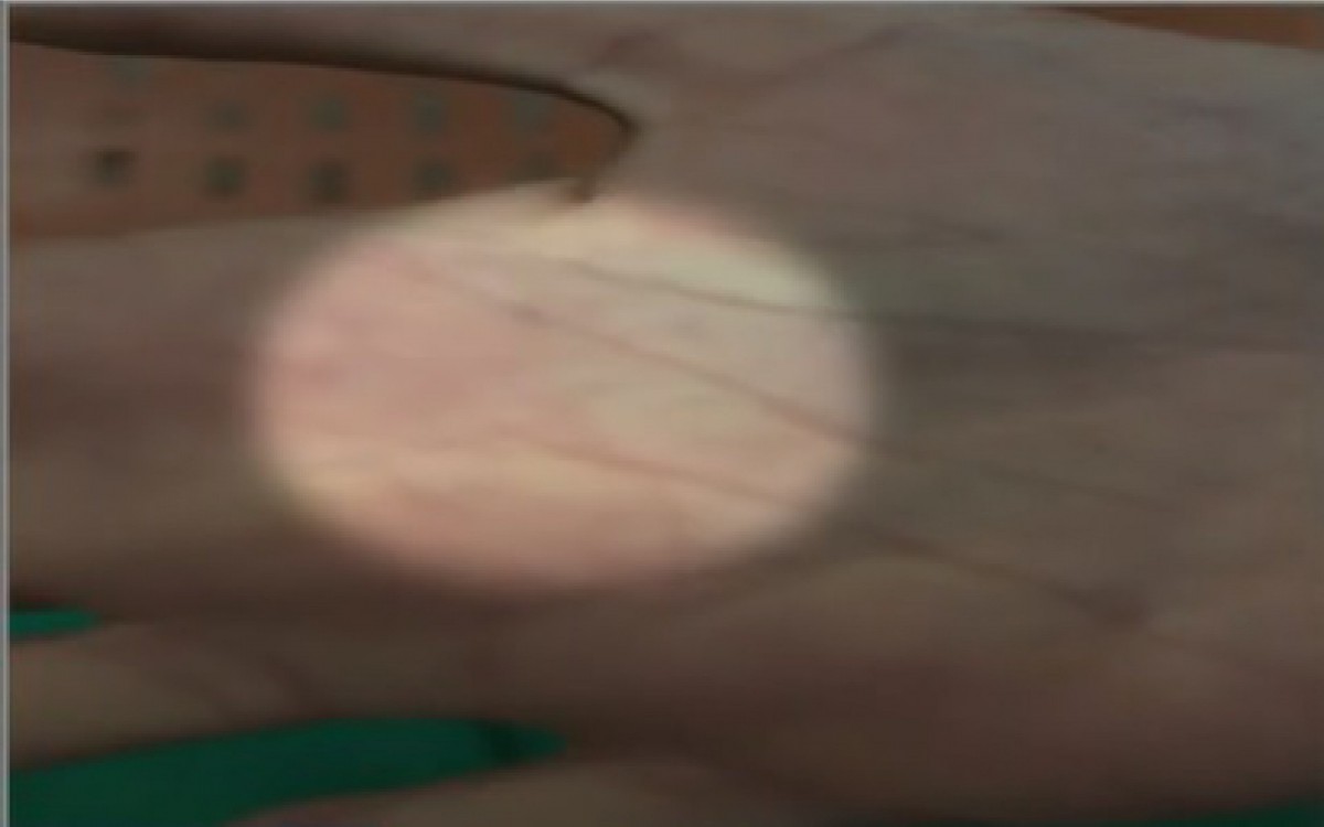 Maternidade escola da UFRJ sofre com infestação de 'piolho de pombo' - Divulgação