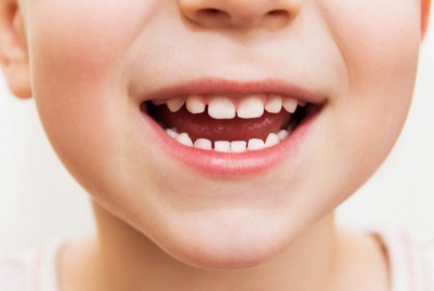 Aprenda sobre a saúde bucal das crianças