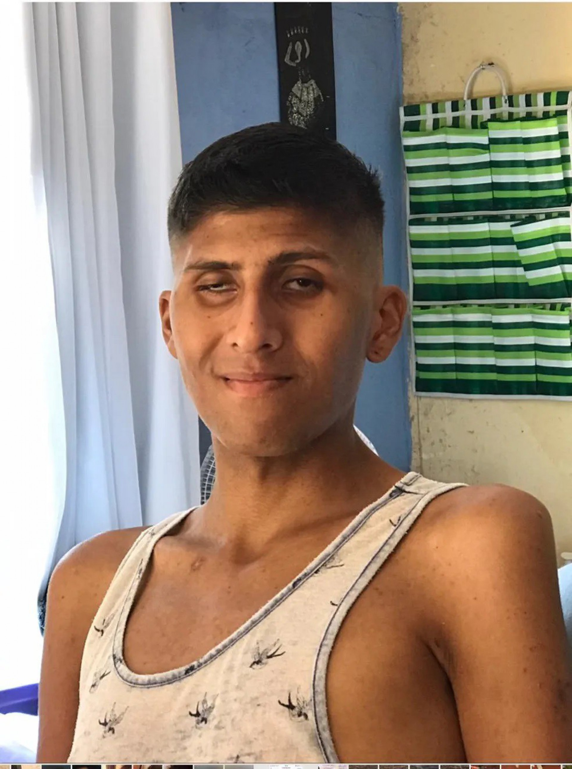 Influenciador Victor Ramos mostra antes e depois do diagnóstico de HIV e surpreende seguidores - Reprodução Internet