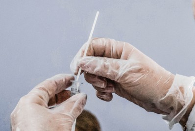 Brasil tem 33,9 mil novos casos e 100 óbitos por covid-19