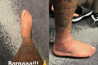 Neymar tem melhora e aumenta a confiança de retorno à Seleção