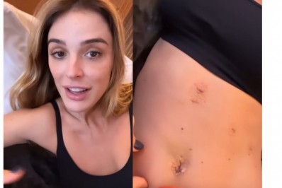 Rafa Brites exibe mudança no corpo devido cirurgia: 'Outra barriga'