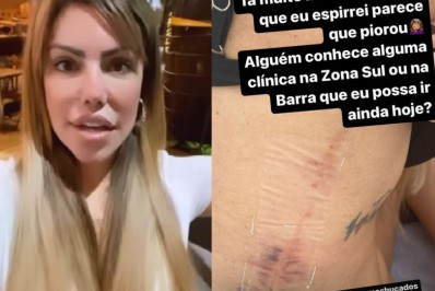 Ex-A Fazenda fratura a costela após brigar por ciúme