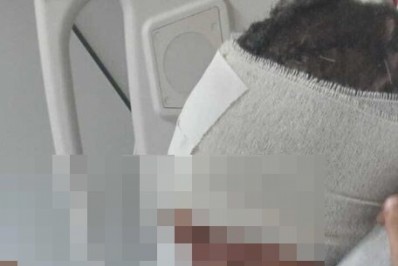 Menino baleado na cabeça fica de pé e tem encontro emocionante com irmão mais novo