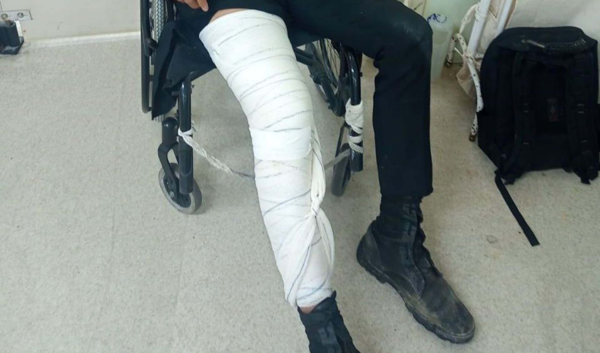 Vítima teve fraturas no joelho depois das agressões em evento no Jockey Club - Arquivo Pessoal