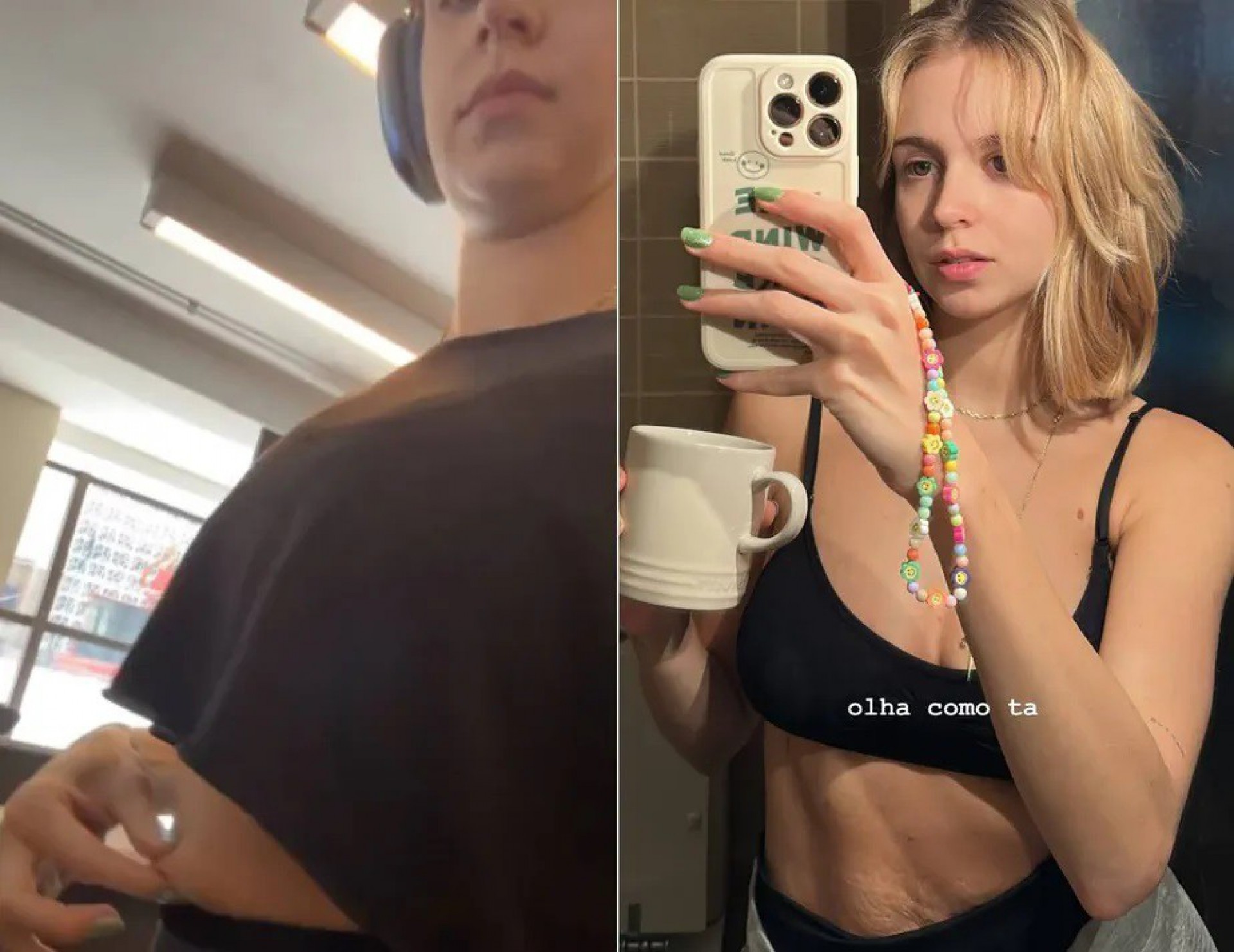 Isabella Scherer fala sobre como tem lidado com flacidez após dar à luz gêmeos - Reprodução / Instagram