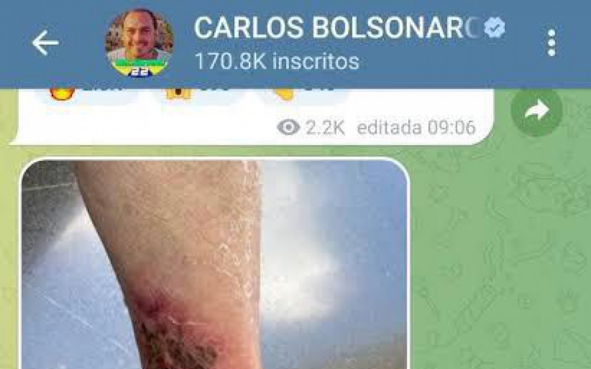  Recentemente, o vice-presidente Hamilton Mourão atribuiu o sumiço ao quadro da erisipela