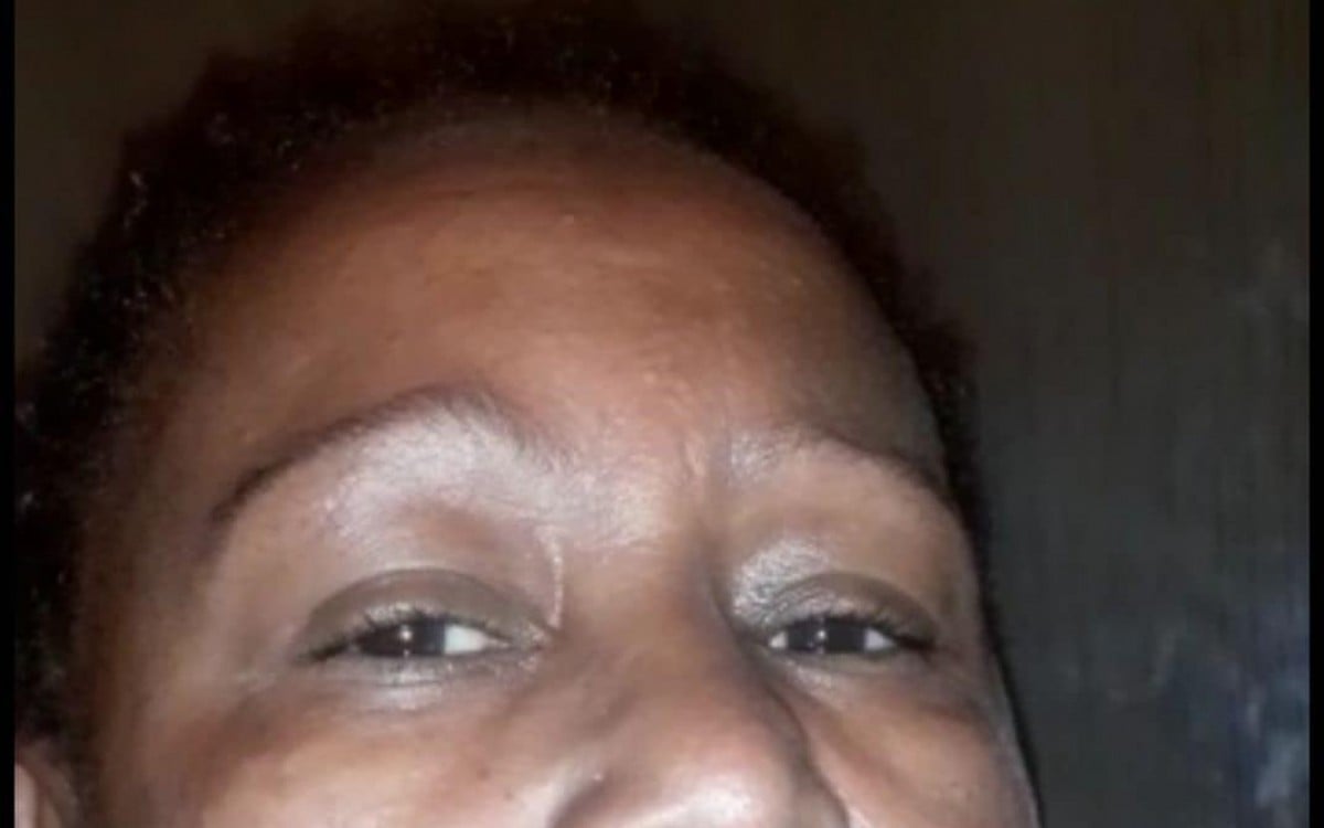 Mônica Valente, de 52 anos, afirma ter sido agredida no rosto por policiais militares do 14º BPM (Bangu)