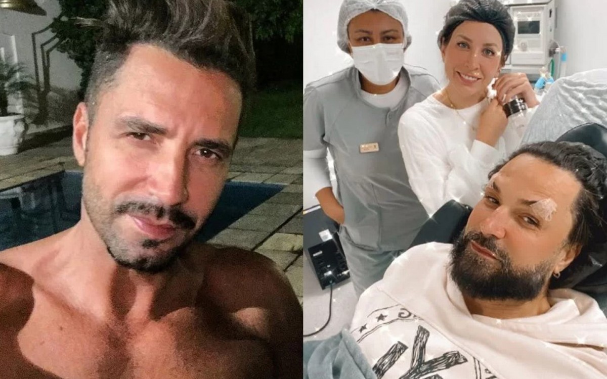 Latino vira meme ap&oacute;s procedimento est&eacute;tico