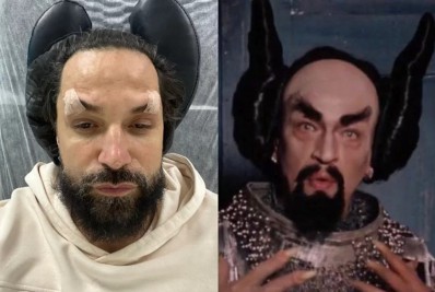 Após procedimento estético, Latino vira meme nas redes sociais e brinca: 'Rindo muito'