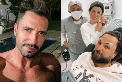 Latino revela que ficou assustado com resultado do rejuvenescimento facial: 'Para ficar bonito, tem que ficar feio'