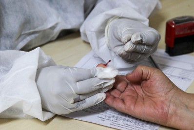 Centro de Triagem volta a funcionar de segunda a sexta-feira