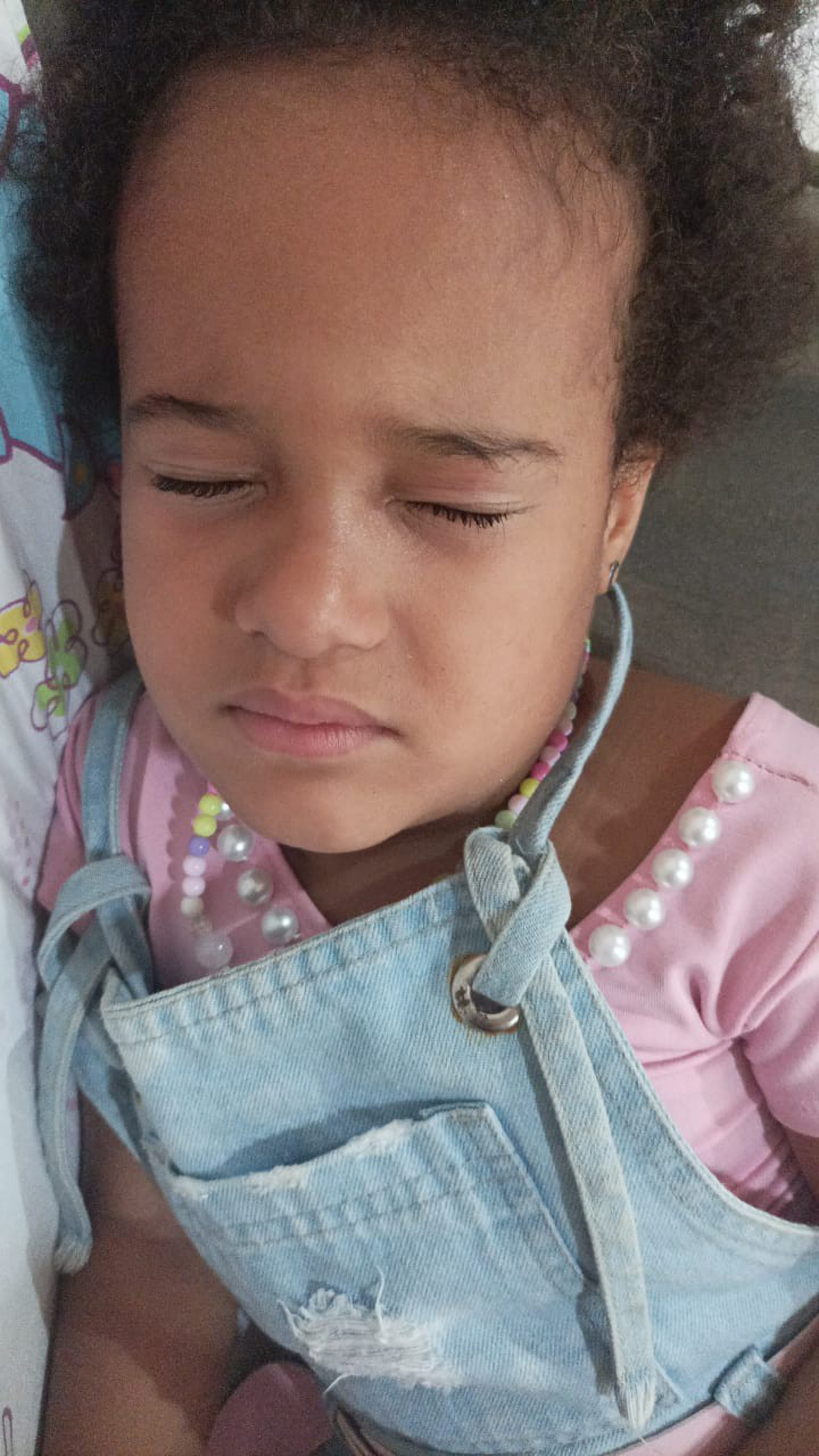 Kauanne da Silva, de 5 anos, sofreu com problemas na vista devido a pomada para tranças - Arquivo Pessoal