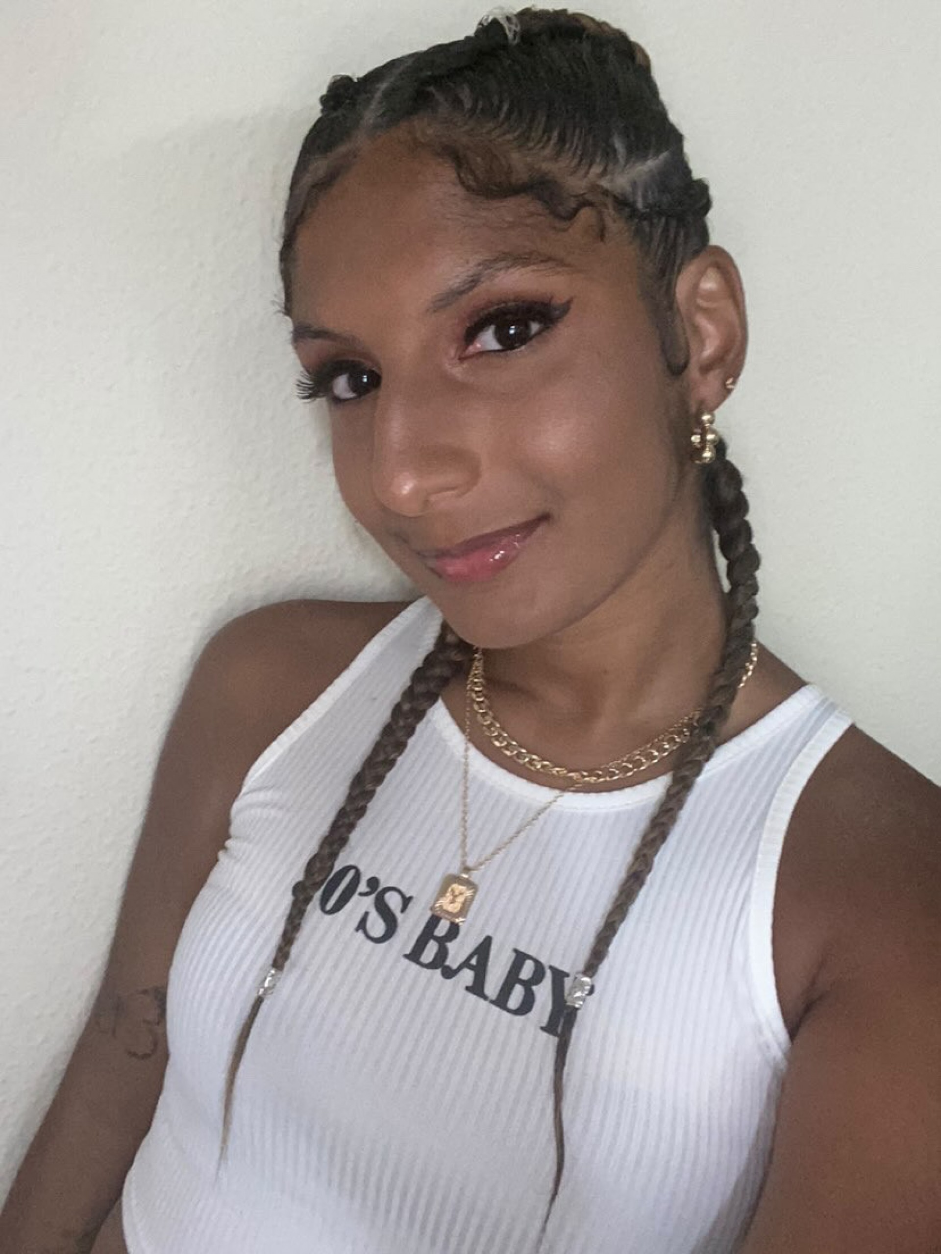 Yasmin Pereira colocou as tran&ccedil;as para o Rock in Rio, mas a chuva junto com a pomada causou queimadura nos olhos - Arquivo Pessoal