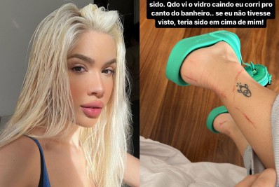 Karoline Lima mostra ferimentos após acidente no banheiro: 'Vidro explodiu'