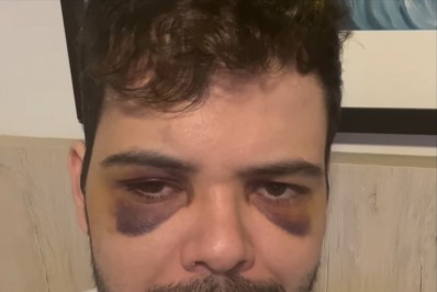 Polícia conclui que humorista Gustavo Mendes não foi vítima de assalto