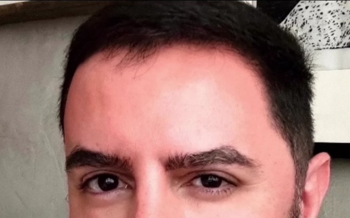 Internautas especulam que Ricardo Tozzi tenha se submetido a uma harmonização facial