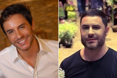 Ricardo Tozzi recebe críticas na web por harmonização facial: 'O que aconteceu?'
