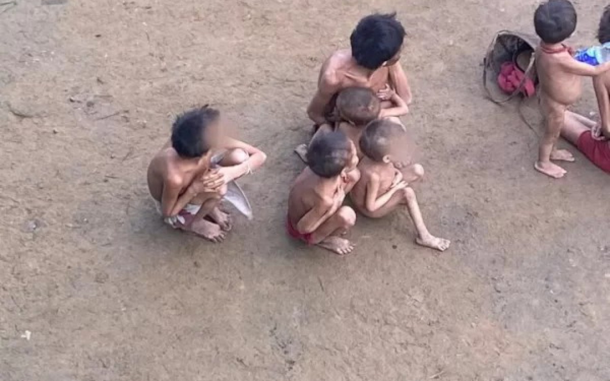 Mortes foram causadas, na maioria dos casos, por desnutrição, pneumonia e diarreia