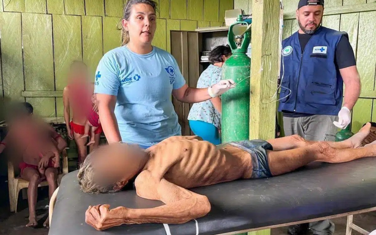 Mortes foram causadas, na maioria dos casos, por desnutrição, pneumonia e diarreia