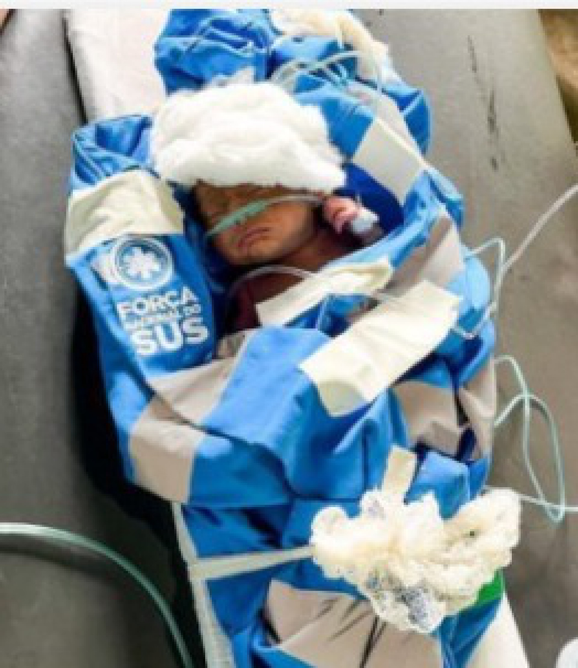 beb&ecirc; Yanomami v&iacute;tima de contamina&ccedil;&atilde;o e inani&ccedil;&atilde;o 