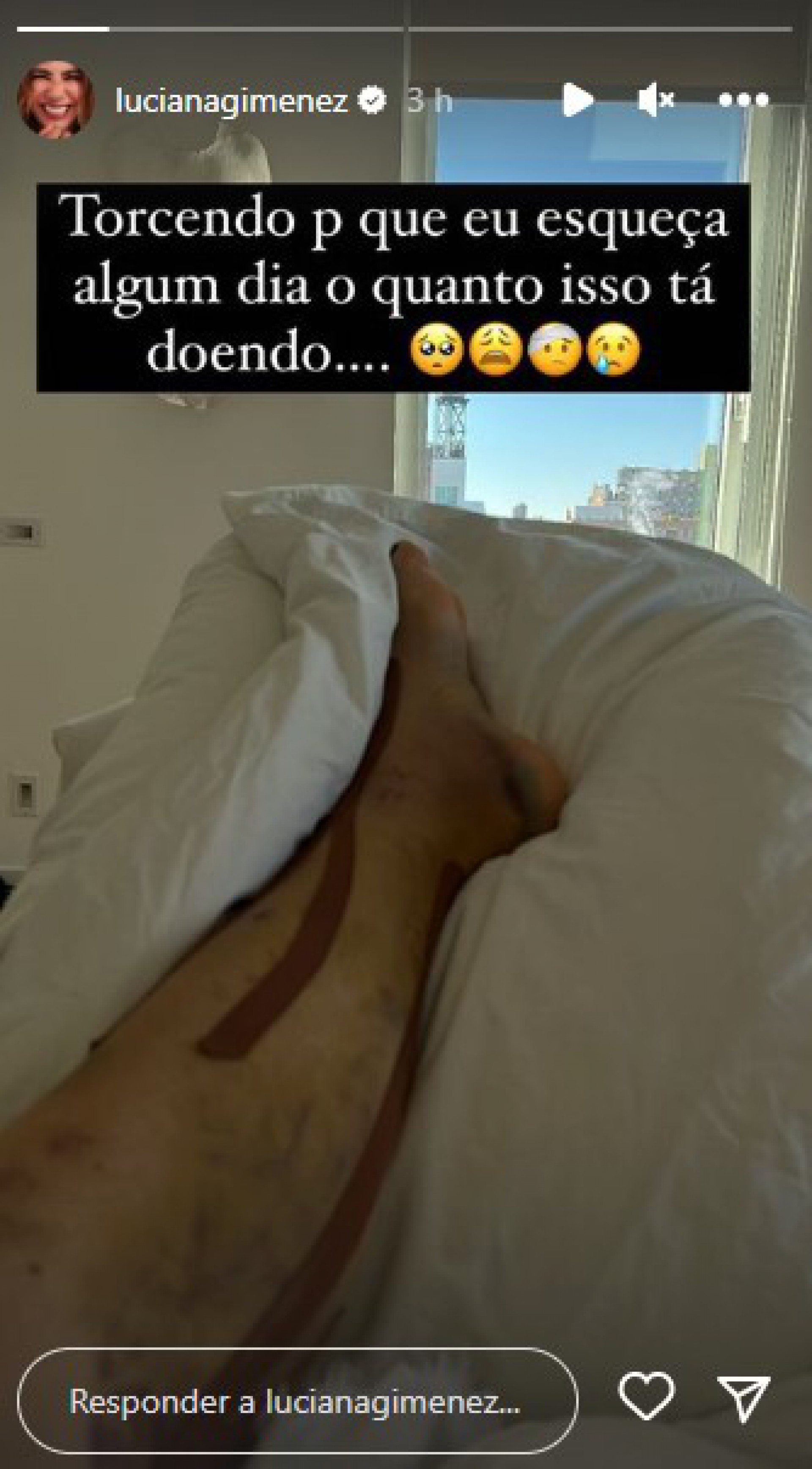 Luciana Gimenez mostra perna roxa em recuperação e remédios para dor - Reprodução Internet