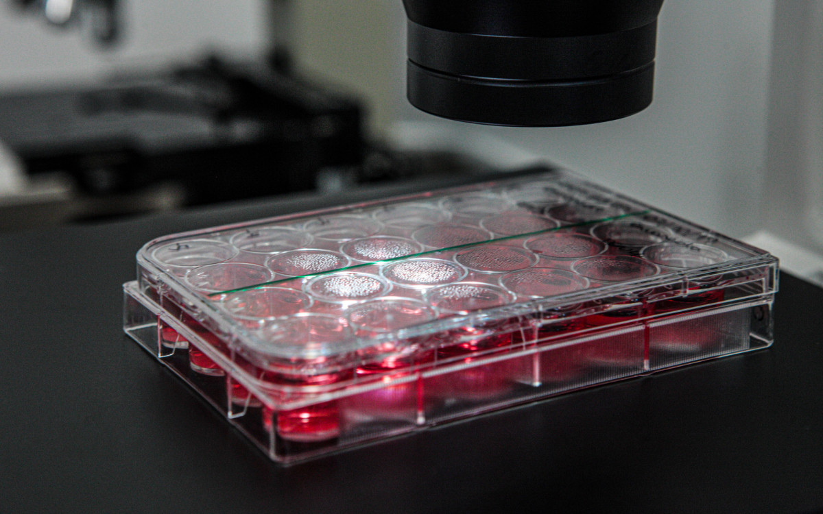 Produ&ccedil;&atilde;o das vacinas contra a dengue e chikungunya no Instituto Butantan