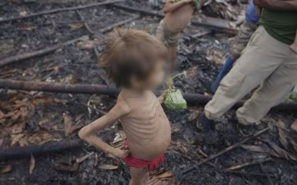 Crise sanitária matou 570 crianças Yanomami de 2019 a 2022