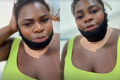 Jojo Todynho passa por procedimento estético e surge com pescoço imobilizado