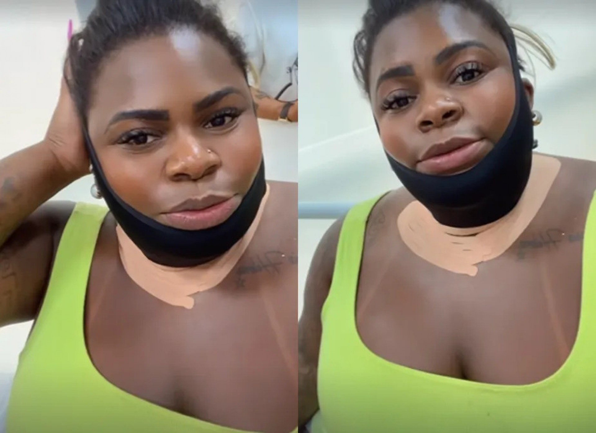 Jojo Todynho surge com o pescoço imobilizado após procedimento estético - Reprodução/Instagram