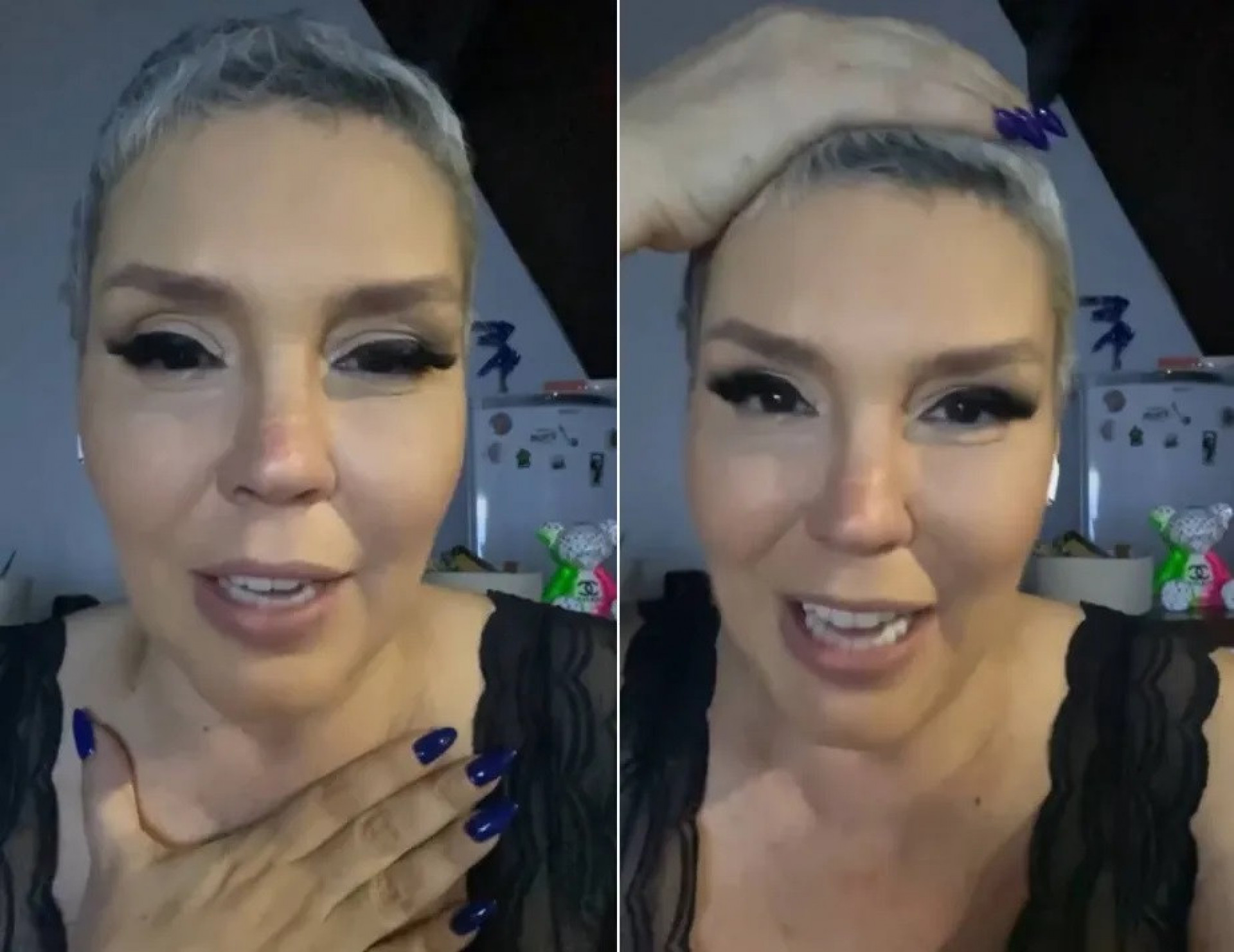 Simony fala sobre recuperação da autoestima após perder os cabelos em decorrência do tratamento contra o câncer - Reprodução / Instagram