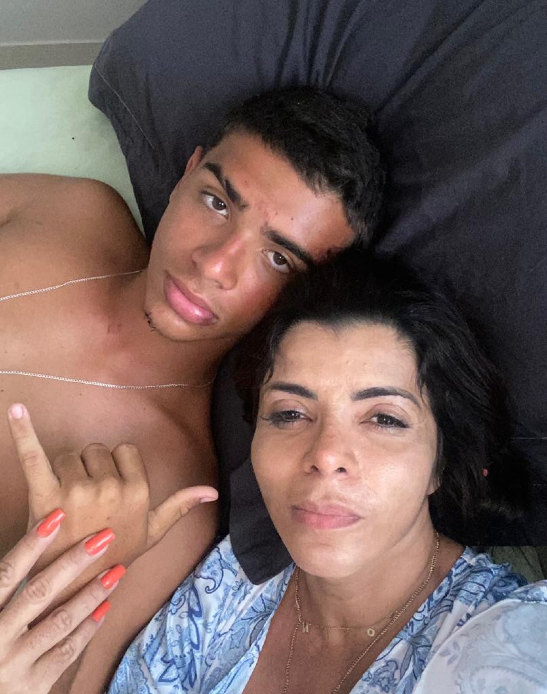 Carlos Magno Constantino Júnior, mais conhecido como Juninho, de 15 anos, é um dos sobreviventes do grave acidente envolvendo a delegação de um time de futebol de Caxias - Divulgação/ Arquivo pessoal