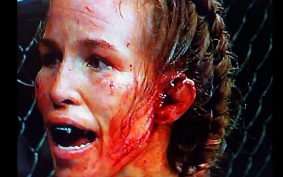 Leslie Smith ficou com a orelha praticamente pendurada ap&oacute;s sofrer soco