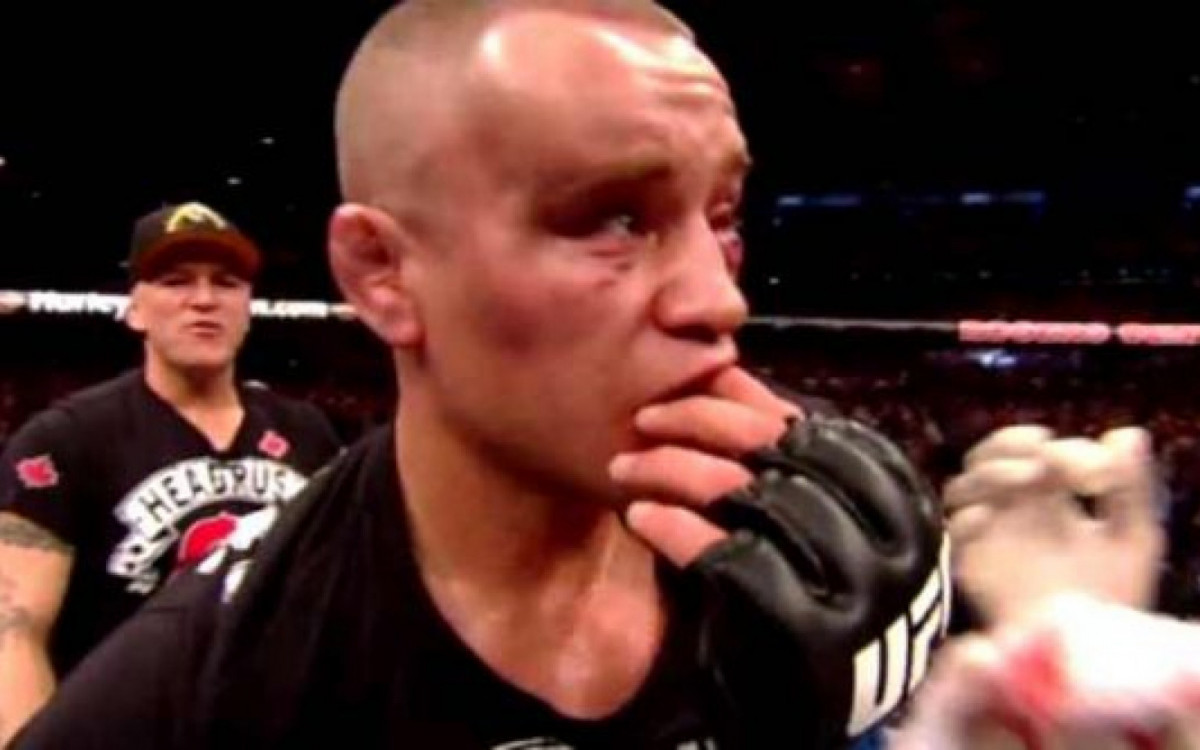  Mark Hominick ficou com um hematoma gigante ap&oacute;s luta com Jos&eacute; Aldo