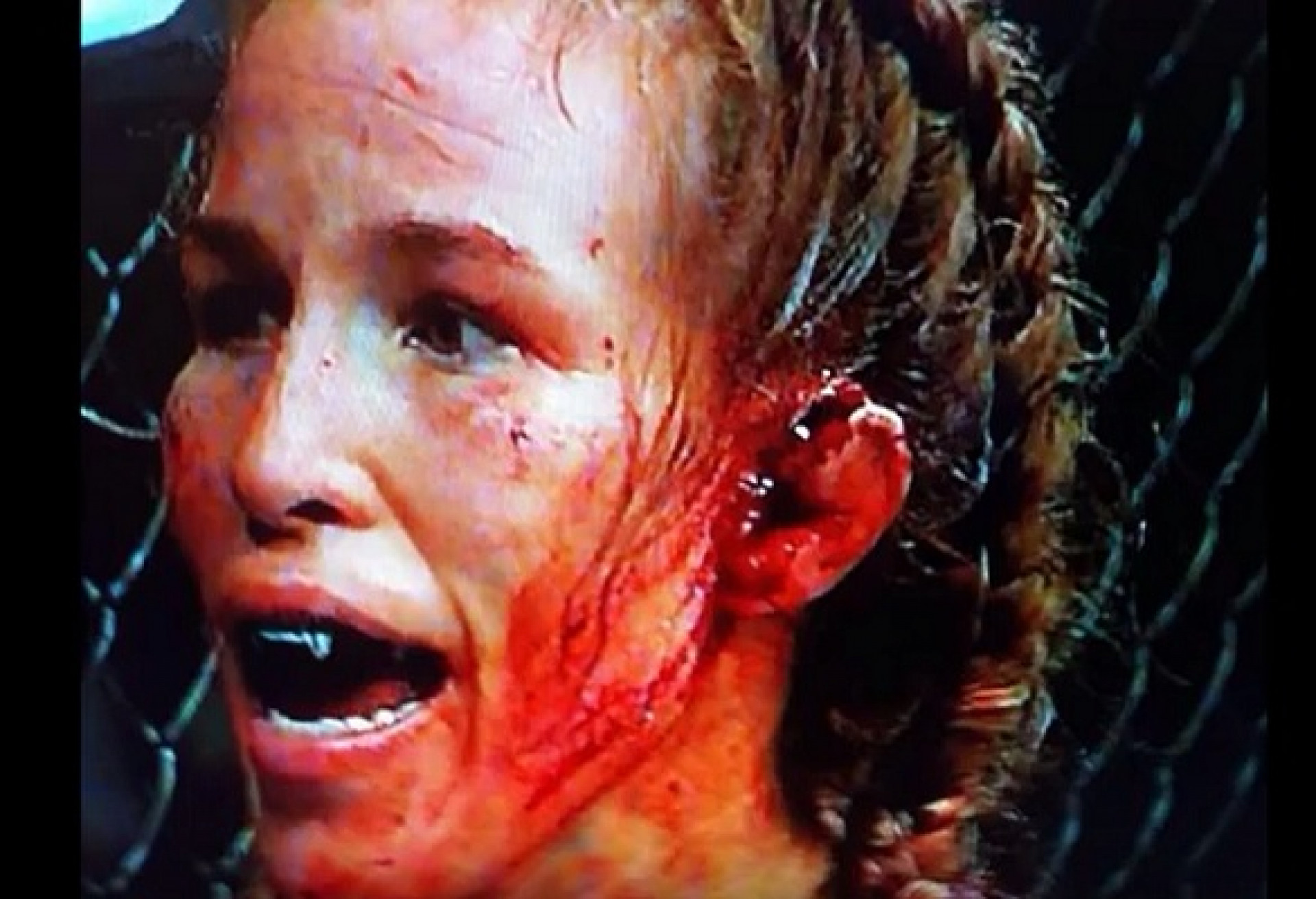 Leslie Smith ficou com a orelha praticamente pendurada ap&oacute;s sofrer soco - (Foto: Reprodu&ccedil;&atilde;o)