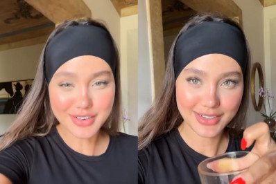 Biah Rodrigues realiza cirurgia para redução da testa