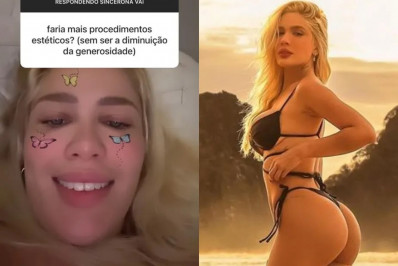 Karoline Lima faz piada ao falar de procedimentos estéticos: 'Não sou planta para ser natural'