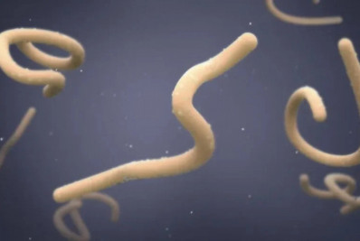 Uganda declara fim de surto de ebola  