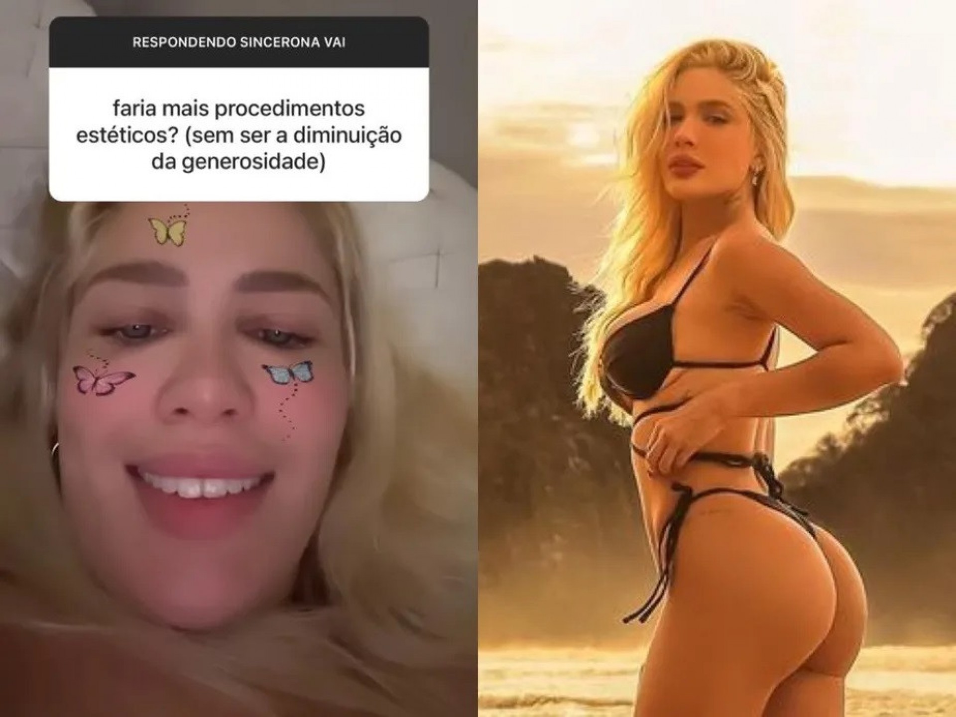 Karoline Lima admite que pretende continuar realizando procedimentos estéticos - Reprodução / Instagram
