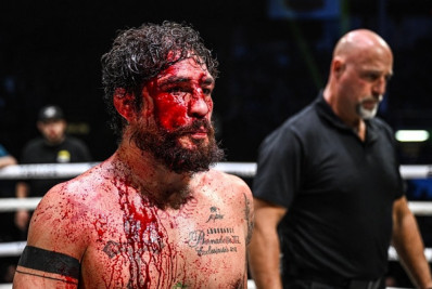 Ex-lutador do UFC leva 'surra' e é derrotado em estreia no Boxe sem luvas