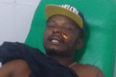 Ambulante é atingido por bala de borracha durante Carnaval em Cabo Frio