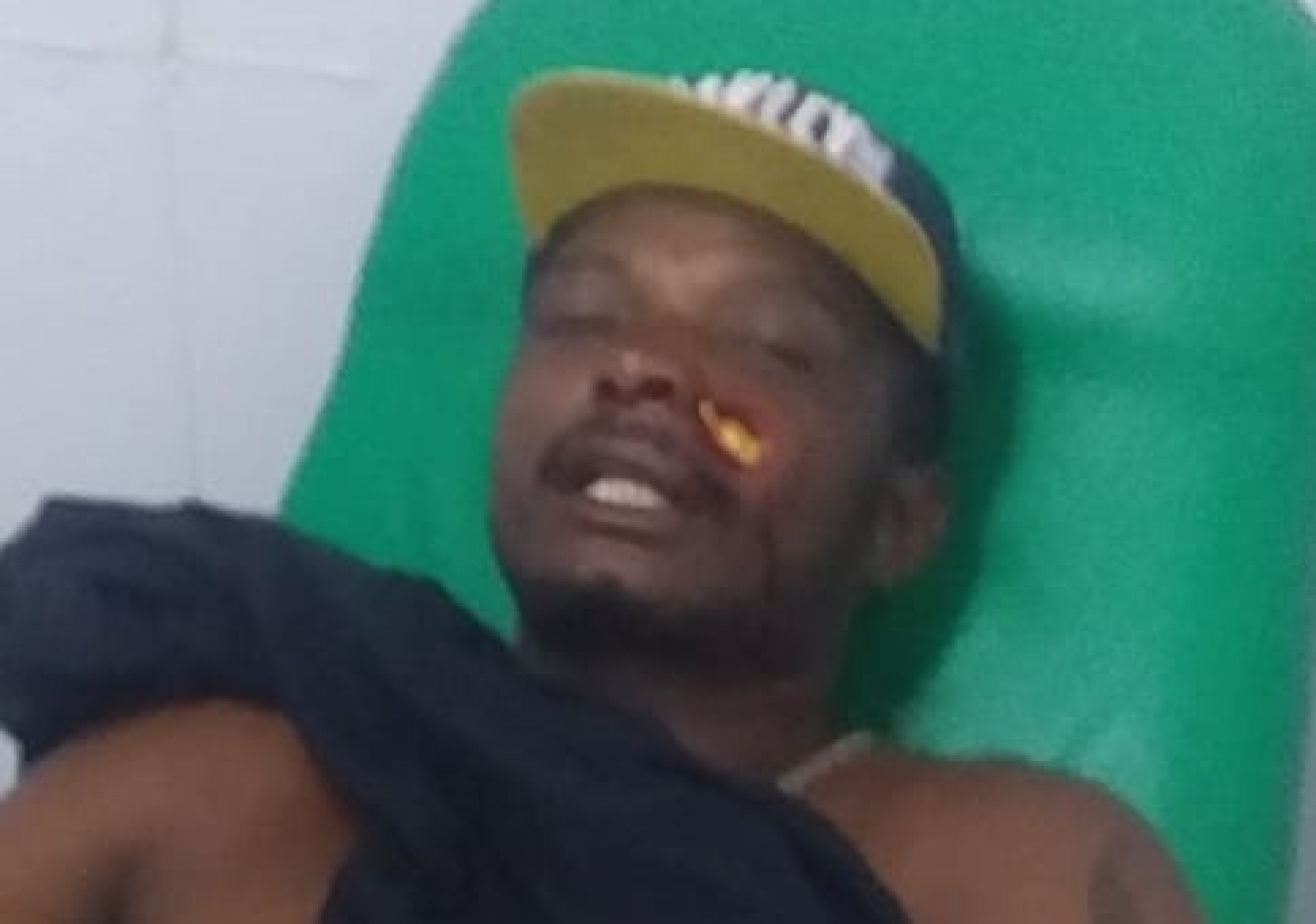 Bala de borracha ficou alojada no rosto do ambulante - Letycia Rocha (RC24h)